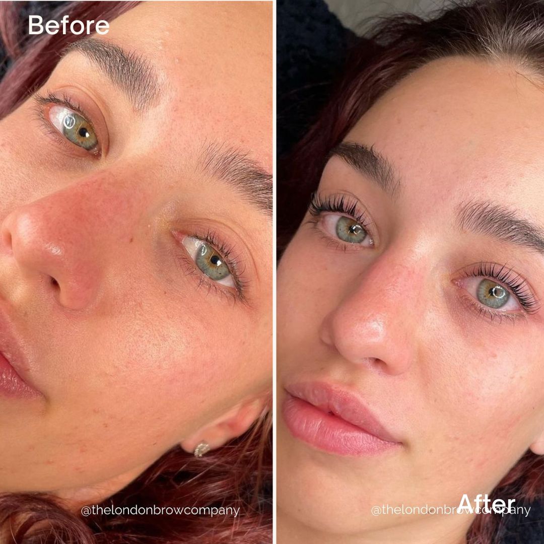 London Speed-Lift Lash Lifting System - Full Kit