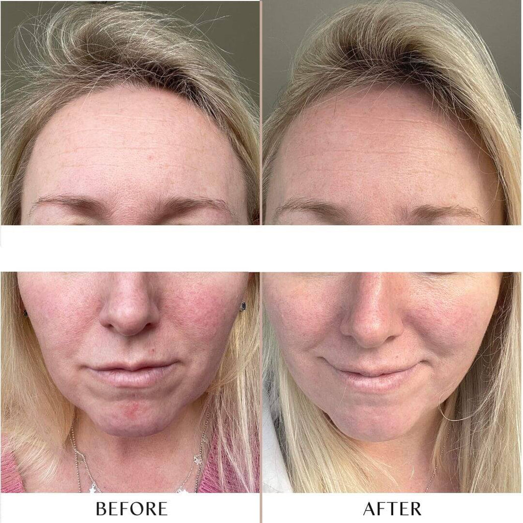 Replenish Hydrating Serum