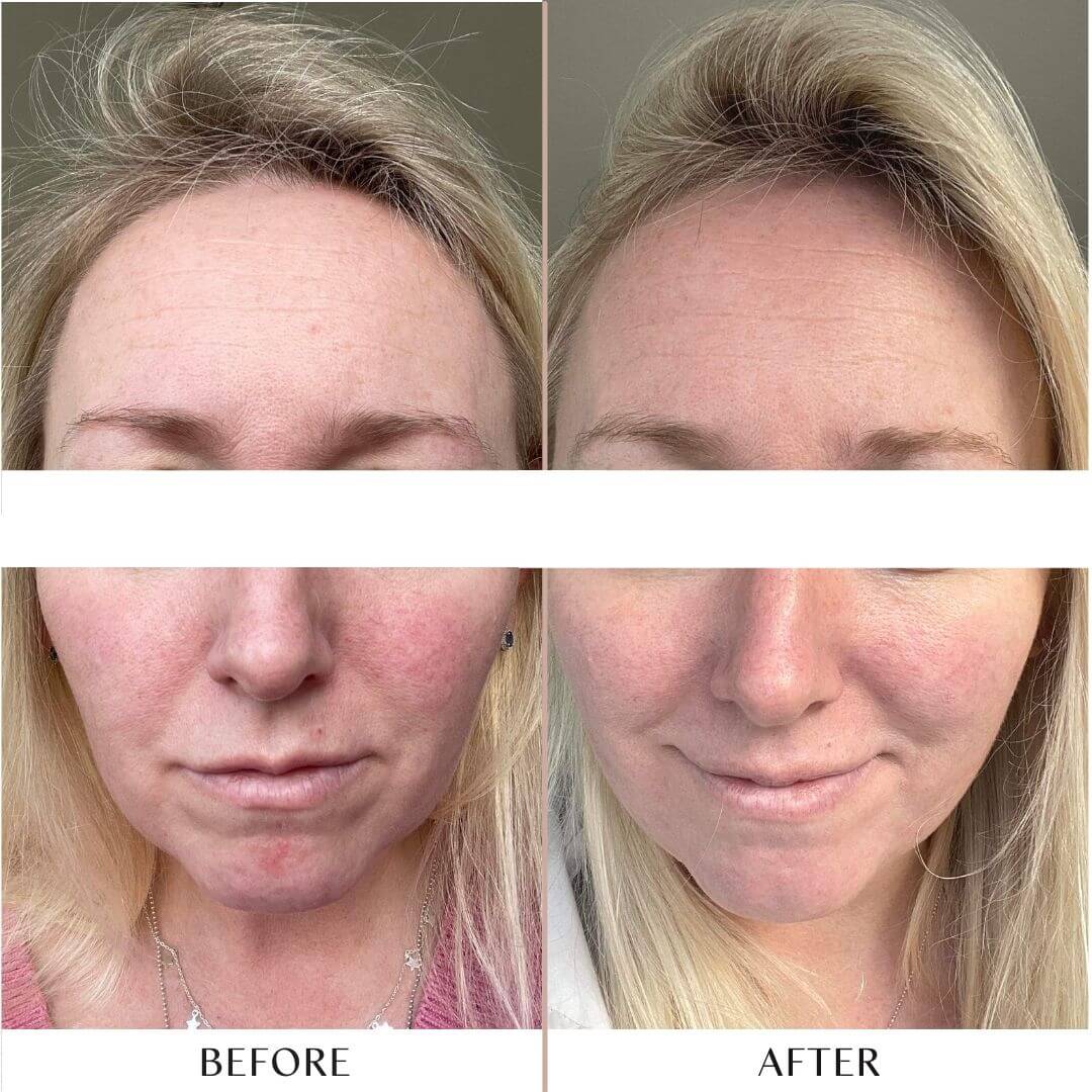 Replenish Hydrating Serum
