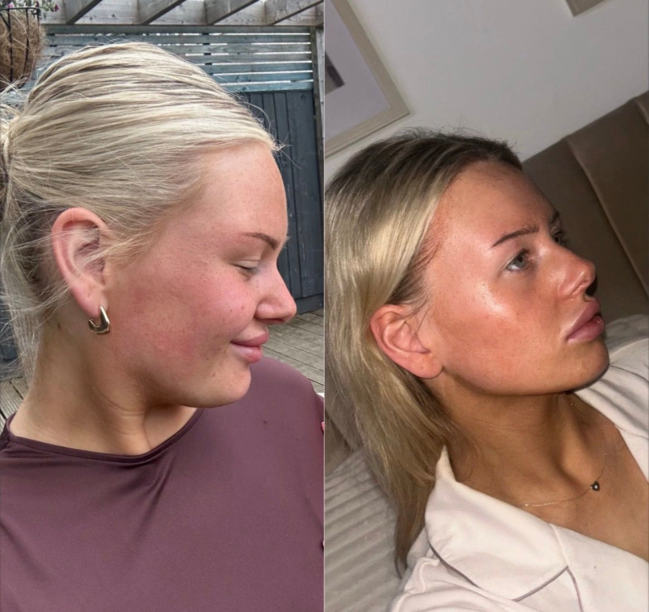 The Hyaluronic Hydrator