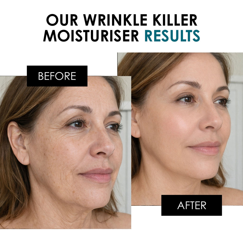 Wrinkle Killer Night Moisturiser 50ml (NEW FORMULA)