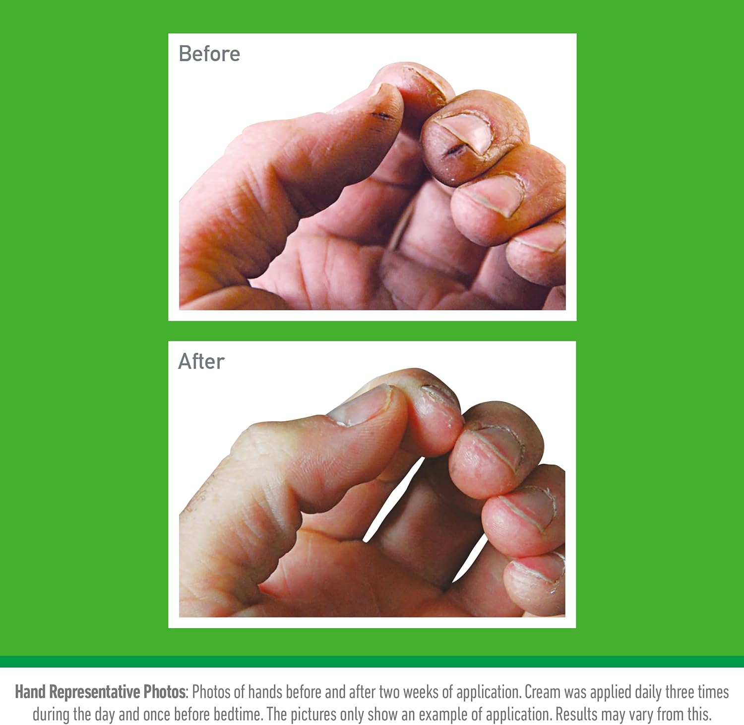 O'Keeffe's Working Hands Value Jar 193g Relief for Extremely Dry, Cracked Hands & Feets