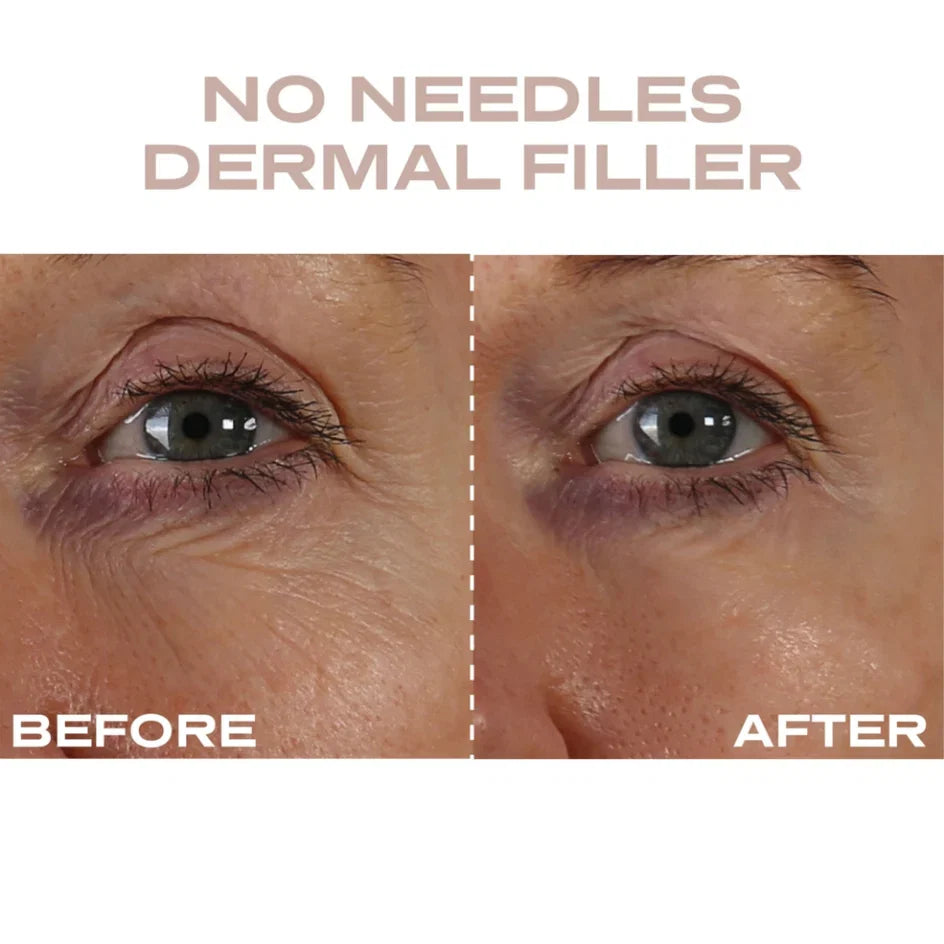 Plump It! - At Home Clinic Box